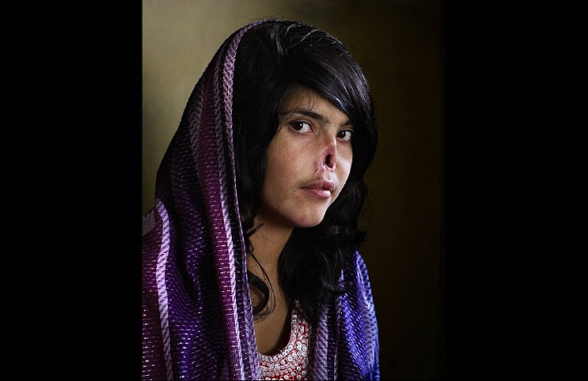 11. Bibi Aisha. Foto: Jodi Bieber / Time Magazine.